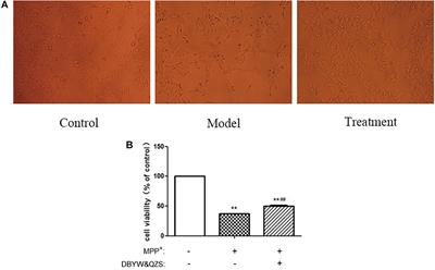 Da-Bu-Yin-Wan and Qian-Zheng-San Ameliorate Mitochondrial Dynamics in the Parkinson’s Disease Cell Model Induced by MPP+